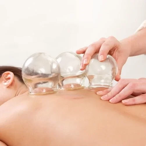 Integrative Medicine Annapolis MD Cupping Integrative Medicine Annapolis MD Cupping